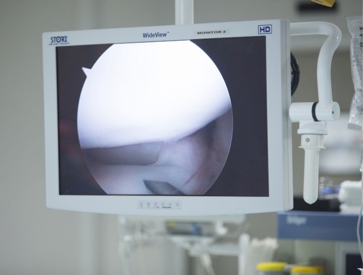 Endoscopy Videoscope
