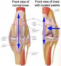 Knee Surgery